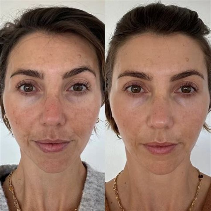 Nelly Furtado's Transformation: A Before And After Look