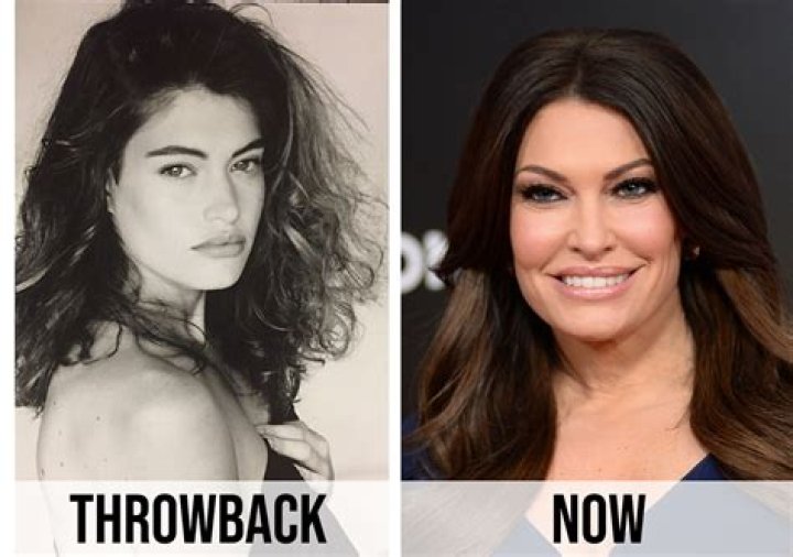 Transformative Journey: The Kimberly Guilfoyle Changes